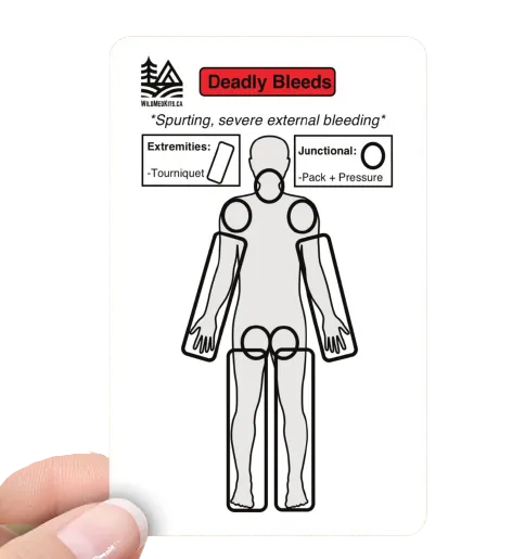 Life Threatening Bleeding Card